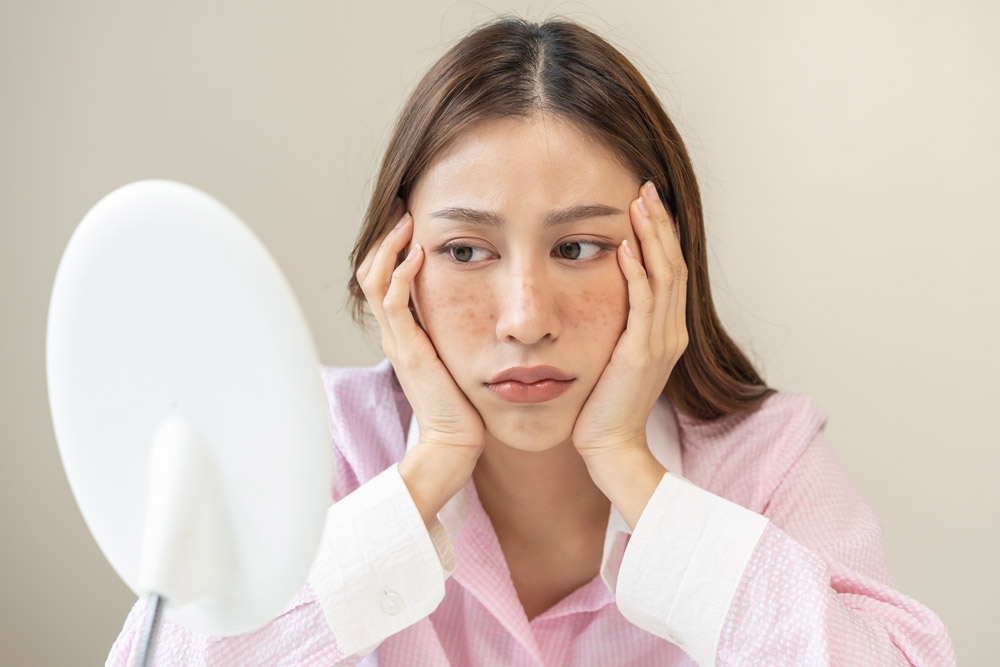 シミとそばかすの違いは何?それぞれの予防・対策方法を解説!