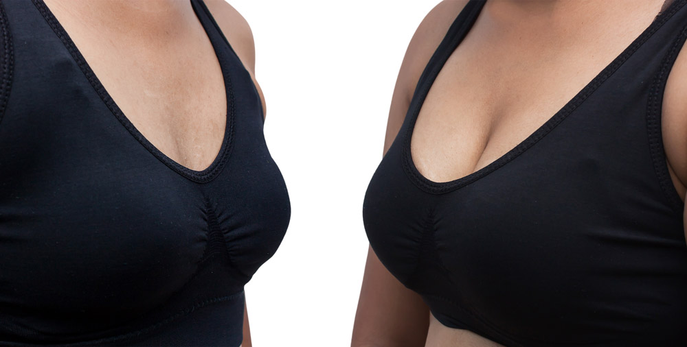 ぽっちゃりなのに貧乳なのはどうして?原因と改善方法を解説!